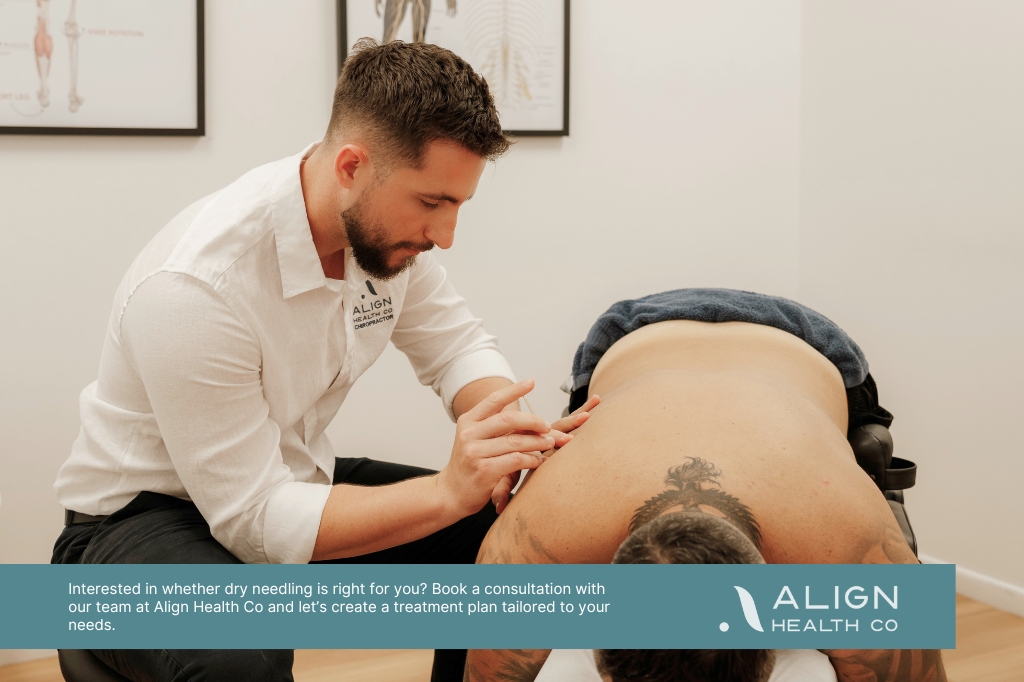Benefits of Dry Needling Therapy | Align Health Co