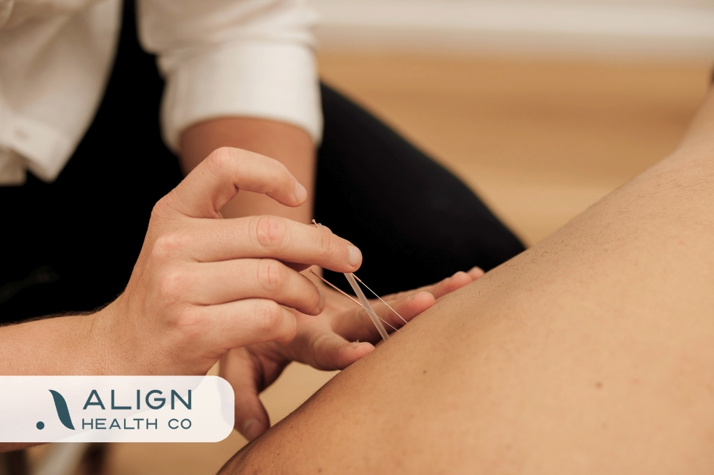 Dry Needling Therapy | Align Health Co