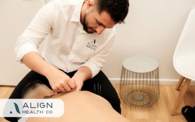 What Is Dry Needling? Everything Mackay Patients Want to Know Before Trying It