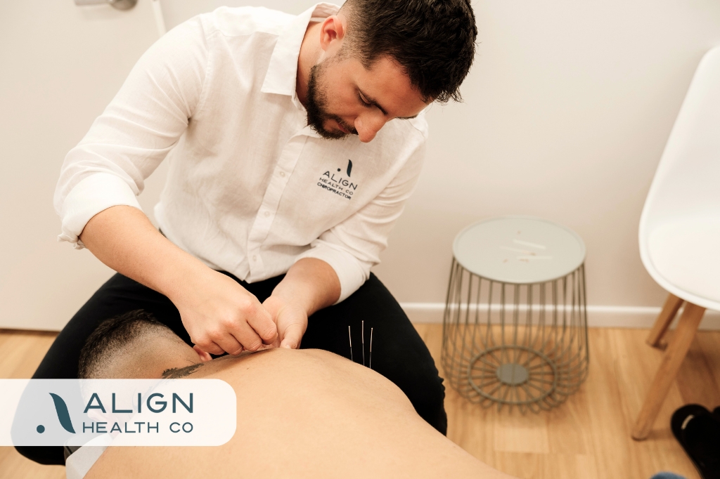How Dry Needling Works | Align Health Co